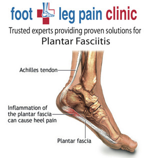 Foot + Leg Pain Clinic - Werribee Pic 2 - Plantar fasciitis treatment