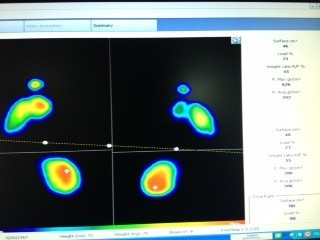 The Foot & Ankle Specialists Pic 2 - We can do a pressure analysis of your feet