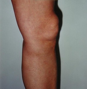 The Vein and Skin Centre Pic 4