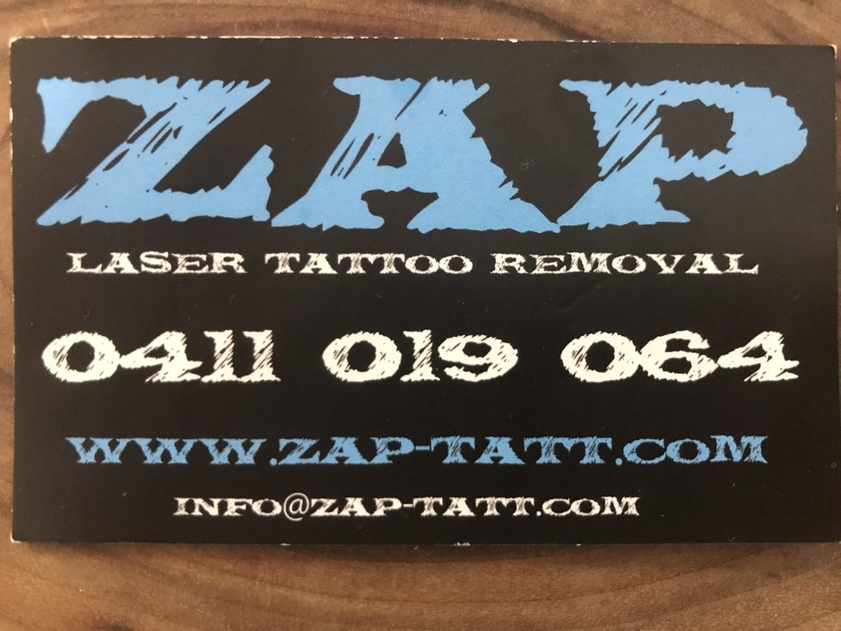 ZAP Laser Tattoo Removal Pic 2