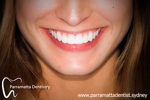 Parramatta Dentistry Pic 4