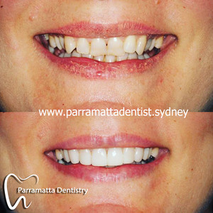 Parramatta Dentistry Pic 5