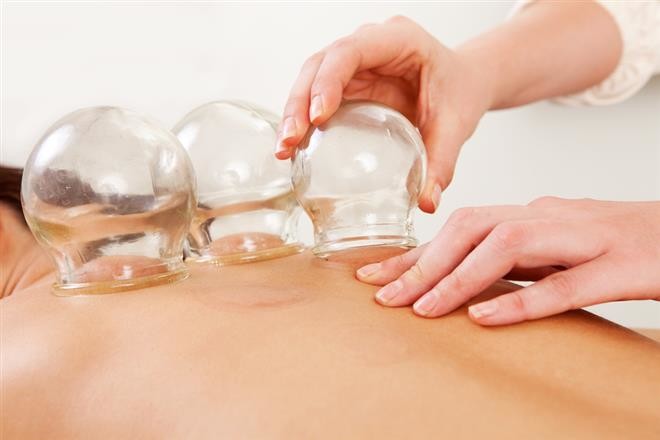 Replenish Health and Beauty Pic 1 - Cupping