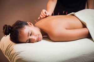 Replenish Health and Beauty Pic 2 - Acupuncture