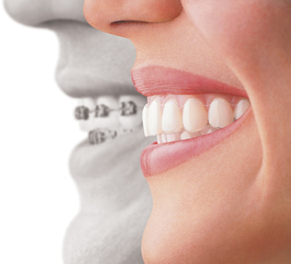 Epping Dental Care Pic 1 - Braces Dental Melbourne