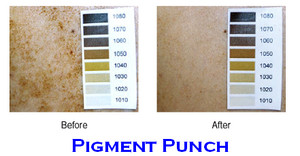 Claramay Beauty Pic 4 - Amazing Results with Pigment Punch Serum and Skincare Treatments