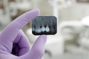 Dentist Mandy Pic 3 - Dental Xrays