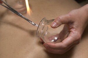 Mitchell Macgregor Pic 4 - Fire cupping