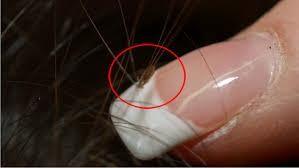 ITCH NO MORE - Specialized Head Lice Treatment Service Pic 4