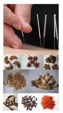 Mei Deng Pic 1 - acupuncture chinese herbal medicine