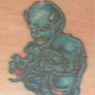 Lynn's Non Laser Tattoo Removal Pic 5