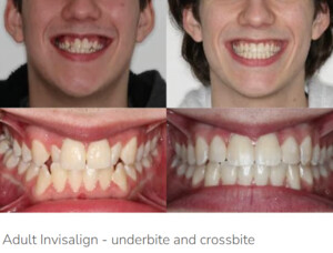 Glow Orthodontics Pic 4