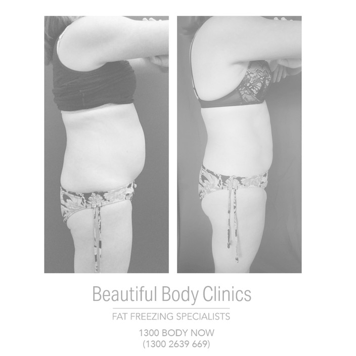 Beautiful Body Clinics Pic 2