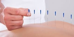 Chi Harmony Center Pic 1 - Acupuncture Treatments in Noosa