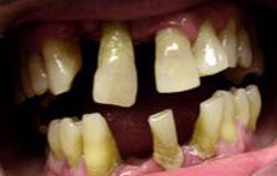 Crown Dental Surgery Pic 2