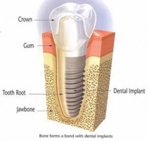 Crown Dental Surgery Pic 3