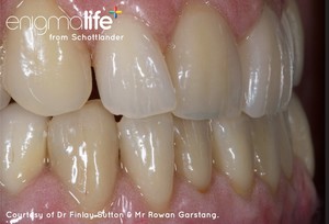 Geelong Denture Care Pic 2