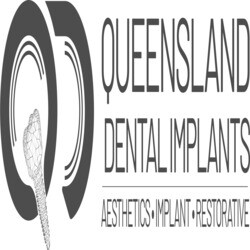 Queensland Dental Implants Pic 1