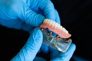 Denture Clinic in Moama | Signature Denture Studio Pic 5