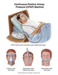 MyCpap Pic 3