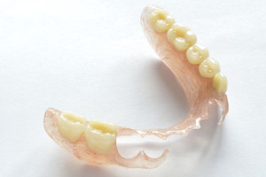 SA Precision Dentures Pic 3 - Flexible Partial Dentures no wires