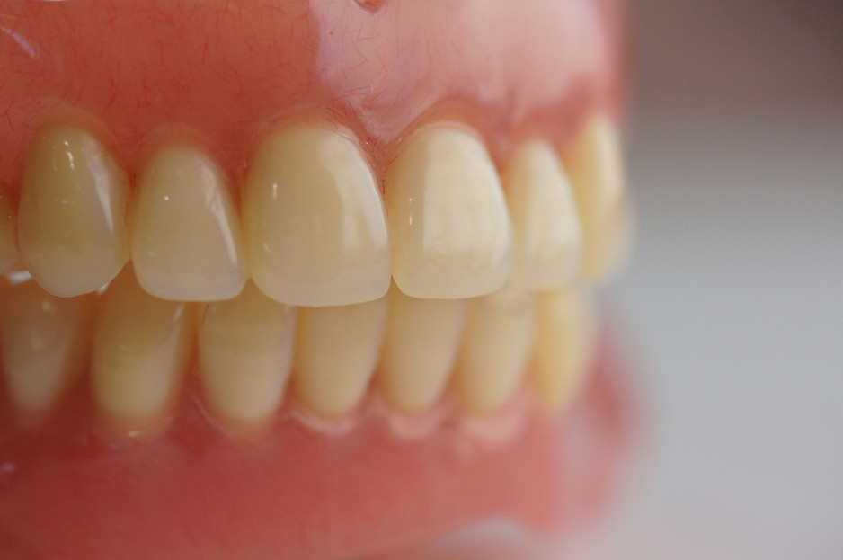 SA Precision Dentures Pic 1 - Full Dentures