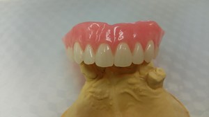 Odonto Denture and Mouthguard Clinic Pic 3