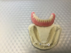 Odonto Denture and Mouthguard Clinic Pic 4