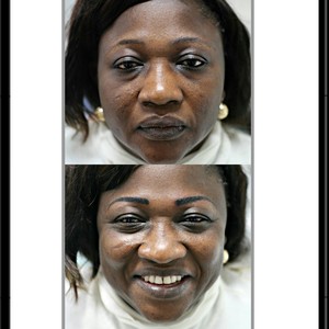 Permanent Makeup Melbourne Pic 3 - Before and after