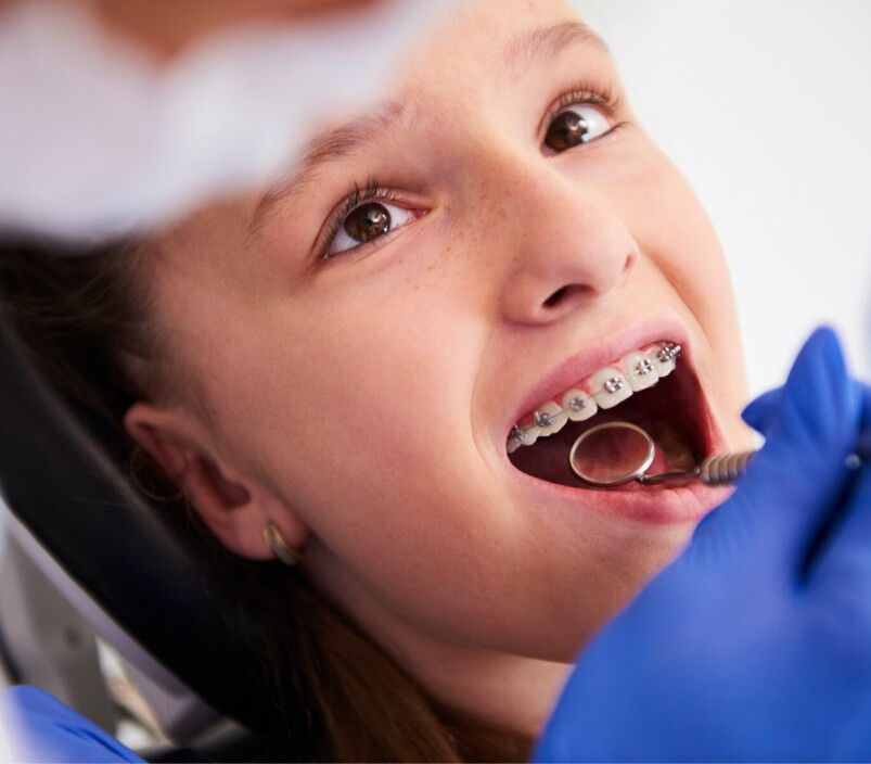 Teeth Straightening Adelaide Pic 2 - My Dentist Your Trusted Teeth Straightening Experts in Adelaide