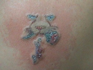 Tattoo Removal WA Pic 5 - Cat with rose directly after a treatment