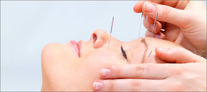 Muscle Dynamics Massage & Myotherapy Clinic Pic 2 - Facial Rejuvenation Dry Needling