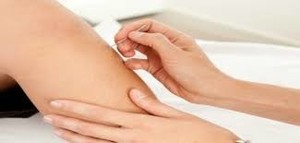 Muscle Dynamics Massage & Myotherapy Clinic Pic 4 - Dry Needling