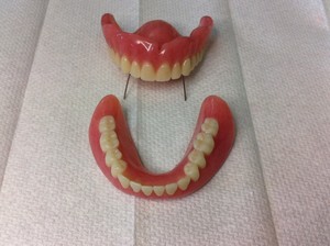 Belmont Denture Clinic Pic 2 - Full Partial Acrylic Chrome and TCS Flexible Dentures available Quality Hand Crafted