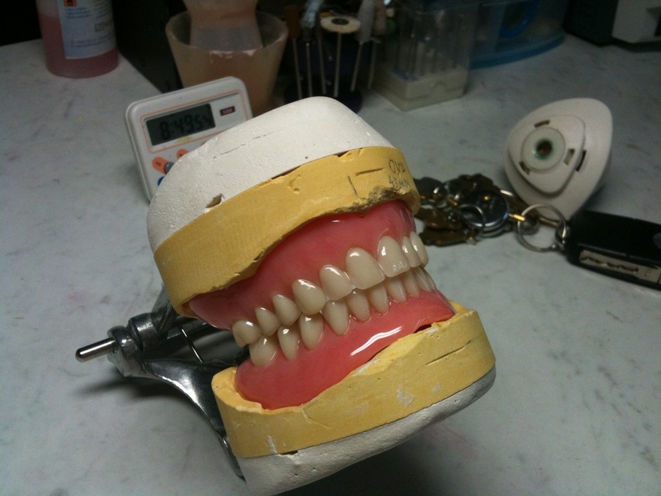 Northside Denture Clinic Pic 1 - Example of a FullFull Denture