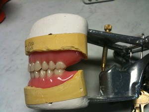 Northside Denture Clinic Pic 2 - Example of a FullFull Denture