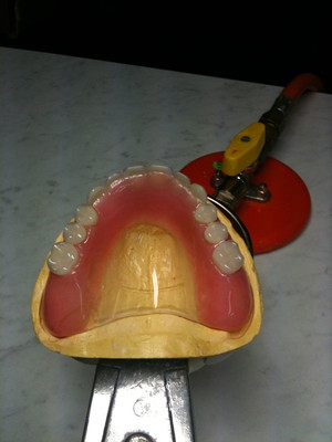 Northside Denture Clinic Pic 4 - Full upper denture with clear palate