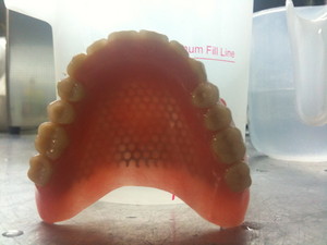 Northside Denture Clinic Pic 5 - Full upper denture with mesh palate for strength