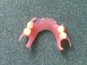 Brian Gow Dental Laboratory Pic 3 - Brian Gow Dental Lab Flexible Denture