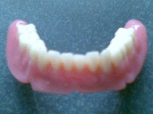 Brian Gow Dental Laboratory Pic 4 - Brian Gow Dental Lab Full lower denture