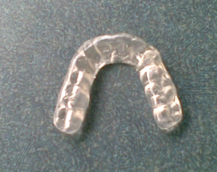 Brian Gow Dental Laboratory Pic 1 - Brian Gow Dental Lab Michigan Splint