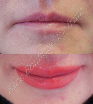 Face Boutique by Irina Pic 2 - Advanced Cosmetic Tattoo Full Lip Melbourne Semi Permanent Makeup 3 D Full Lip Melbourne