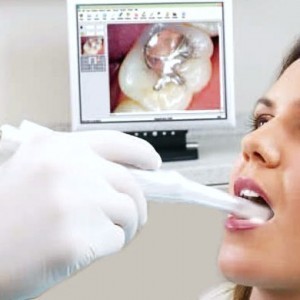 Enhance Dental Pic 4 - Intraoral Camera