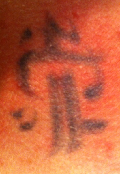 Tatts Away Pic 1 - Before the first treatment