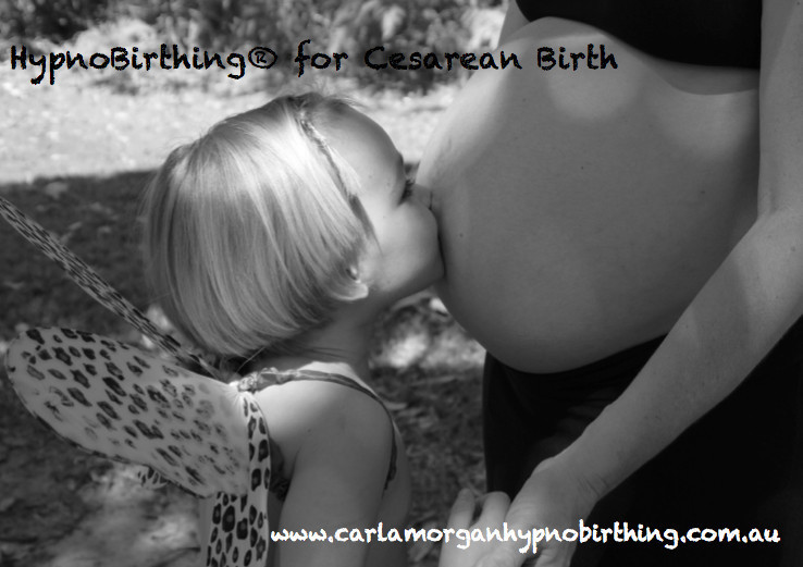 Carla Morgan Hypno Birthing Pic 1 - HypnoBirthing for Cesarean Birth