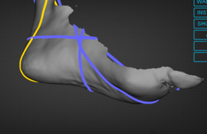 Central West Foot and Ankle Clinic Pic 5