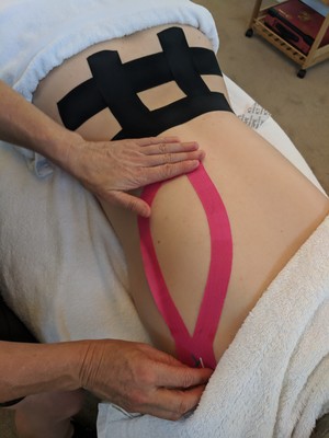 Caring Koala Wellness Centre Pic 5 - Kinesiotaping