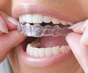 Yokine Dental Centre Pic 4 - We offer clear aligners at our practice This assists with the straightening of teeth