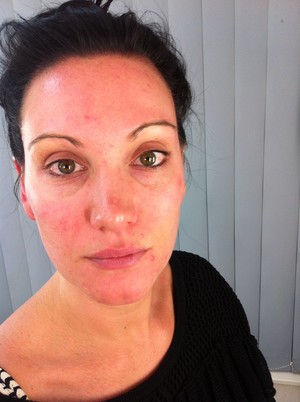 Louise Barton Make Up Artist Pic 4 - BEFORE