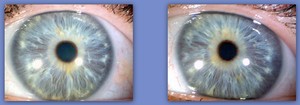 Sydney Iridology Pic 3